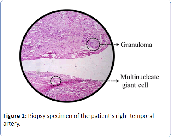 archivesofmedicine-Biopsy-specimen