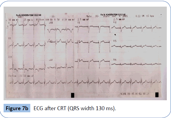 archivesofmedicine-ECG-after