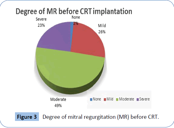 archivesofmedicine-mitral-regurgitation