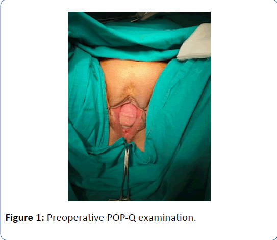 An Approach To Managing Pelvic Organ Prolapse In